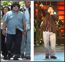 Diego Maradona before and after successful gastric bypass surgery